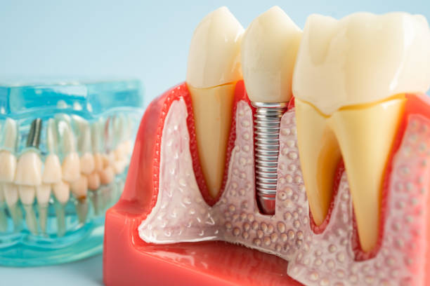 Oral Surgery in Lemoore, CA