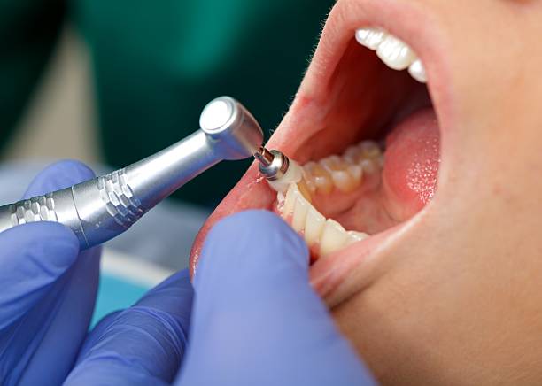 Professional Dental Services in Lemoore, CA